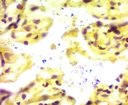 Gram Staining Kit 250ml