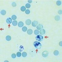 Reticulocyte Stain