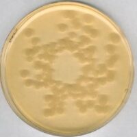 Tryptic Soy Agar