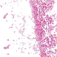 Gram′s Iodine Solution