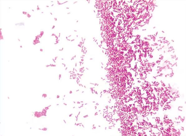 Gram′s Iodine Solution