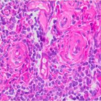 Harris Hematoxylin Solution